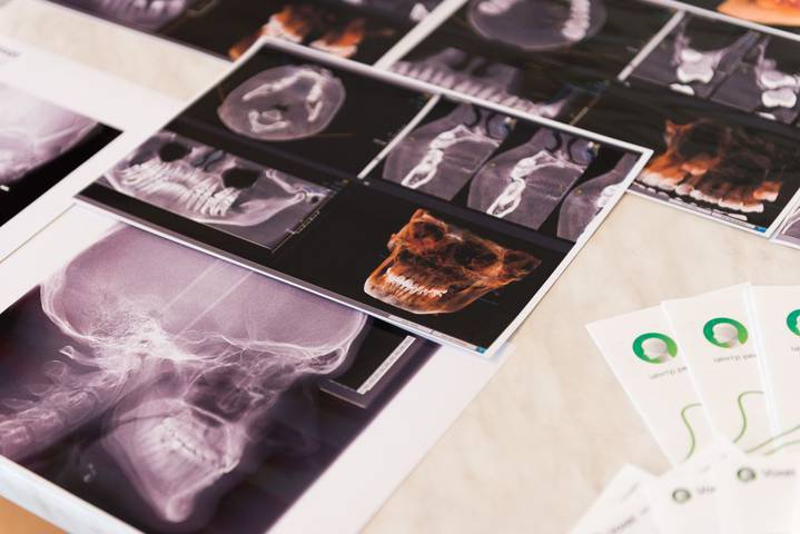 Комплексные